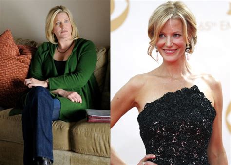 anna gunn weight gain|Anna Gunn opens up about her heavily criticised weight gain